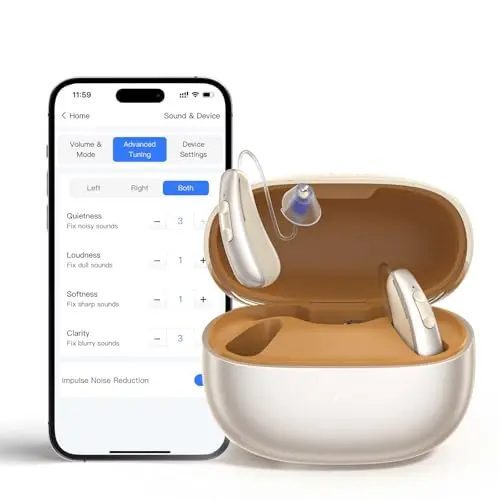 iBstone AuraLink beige-colored RIC (Receiver-in-Canal) Bluetooth hearing aids with a charging case.
